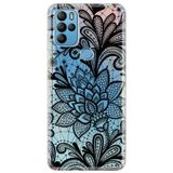 Senada General Mobile Gm 21 Pro Uyumlu İle Uyumlu Kılıf 0.4Mm Lazer Kesim Silikon Kapak Mandala Gül