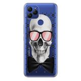 Senada General Mobile Gm 21 Uyumlu İle Uyumlu Kılıf 0.4Mm Lazer Kesim Silikon Kapak Moda Iskelet