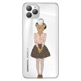 Senada General Mobile Gm 22 Plus İle Uyumlu Kılıf 0.4Mm Lazer Kesim Silikon Stok:Kolejli Leopar