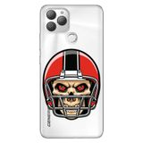 Senada General Mobile Gm 22 Plus İle Uyumlu Kılıf 0.4Mm Lazer Kesim Silikon Stok:Kuru Kafa
