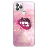 Senada General Mobile Gm 22 Plus İle Uyumlu Kılıf 0.4Mm Lazer Kesim Silikon Stok:Miss Vampire
