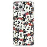 Senada General Mobile Gm 22 Plus İle Uyumlu Kılıf 0.4Mm Lazer Kesim Silikon Stok:Mouse