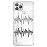 Senada General Mobile Gm 22 Plus İle Uyumlu Kılıf 0.4Mm Lazer Kesim Silikon Stok:Nabız