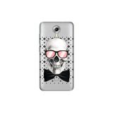 Senada General Mobile Gm 5 Plus İle Uyumlu Kılıf 0.4Mm Lazer Kesim Silikon Kapak Moda Iskelet