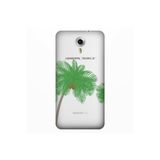 Senada General Mobile Gm 5 Plus İle Uyumlu Kılıf 0.4Mm Lazer Kesim Silikon Kapak Palmiye,Color279