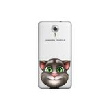 Senada General Mobile Gm 5 Plus İle Uyumlu Kılıf 0.4Mm Lazer Kesim Silikon Kapak Tom