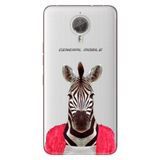 Senada General Mobile Gm 5 Plus İle Uyumlu Kılıf Silikon Desenli Tam Koruma Resimli Şirin Zebra