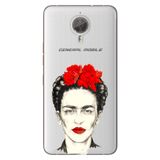 Senada General Mobile Gm 5 Plus İle Uyumlu Kılıf Silikon Desenli Tam Koruma Resimli Xfridax