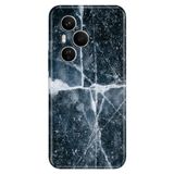 Senada Huawei Honor 400 Pro İle Uyumlu Kılıf Dekoratif Silikon Baskılı Kapak Bells Mermer