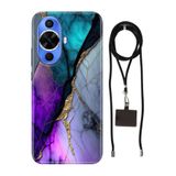 Senada Huawei Nova 12S ile Uyumlu Kılıf Altın Tozu Silikon İpli Boyun Askısı