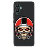 Senada Infinix Hot 12 İle Uyumlu Kılıf Silikon Desenli Resimli Uv Kapak Kuru Kafa