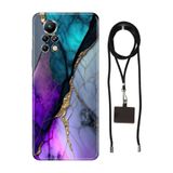 Senada Infinix Note 11 Pro ile Uyumlu Kılıf Altın Tozu Desenli Silikon İpli Boyun Askı Aparatı