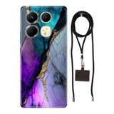 Senada Infinix Note 40 4G ile Uyumlu Kılıf Altın Tozu Silikon İpli Boyun Askı Aparatı
