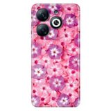 Senada Infinix Smart 8-8 Pro İle Uyumlu Kılıf Uv-Color Telefon İle Uyumlu Kılıfı Vip Baskılı Çiçekli Sss