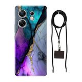 Senada Infinix Zero 30 4G ile Uyumlu Kılıf Altın Tozu Silikon İpli Boyun Askı Aparatı