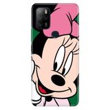 Senada Omix X300 - X500 ile Uyumlu Kılıf Resimli Desenli Silikon Minnie Smile