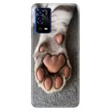 Senada Oppo A55 4G ile Uyumlu Kılıf Resimli Desenli Silikon Pati