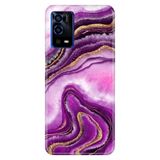 Senada Oppo A55 4G ile Uyumlu Kılıf Resimli Desenli Silikon Pembe Ametist