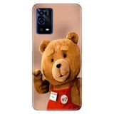 Senada Oppo A55 4G ile Uyumlu Kılıf Resimli Desenli Silikon Teddy