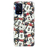 Senada Oppo A55 4G İle Uyumlu Kılıf Silikon Desenli Tam Koruma Resimli Kapak Mouse