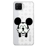 Senada Oppo A73 İle Uyumlu Kılıf Silikon Desenli Tam Koruma Resimli Kapak Mickeyyyyy Karakter