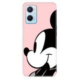 Senada Oppo A96 ile Uyumlu Kılıf Resimli Desenli Silikon 05Mickey