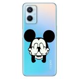 Senada Oppo A96 İle Uyumlu Kılıf Silikon Desenli Tam Koruma Resimli Kapak Mickeyyyyy Karakter