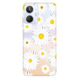 Senada Realme 10 ile Uyumlu Kılıf Silikon Desenli Resimli UV Kapak Papatya