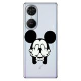 Senada Reeder S19 Max Pro S Edge İle Uyumlu Kılıf Telefon İle Uyumlu Kılıfı Baskılı Mickeyyyyy Karakter