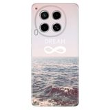 Senada Tecno Camon 30 İle Uyumlu Kılıf Telefon İle Uyumlu Kılıfı Baskılı Dream