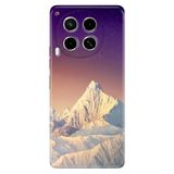Senada Tecno Camon 30 İle Uyumlu Kılıf Telefon İle Uyumlu Kılıfı Baskılı Paramount