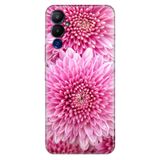 Senada Tecno Pova Neo 4 İle Uyumlu Kılıf Silikon Desenli Tam Koruma Resimli Kapak Chon