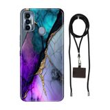 Senada Tecno Spark 7 Pro ile Uyumlu Kılıf Altın Tozu Silikon İpli Boyun Askı Aparatı