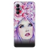 Senada Tecno Spark 8 Pro İle Uyumlu Kılıf Silikon Renkli Desenli Resimli - Miss.World