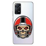 Senada Uyumlu Xiaomi Redmi Note 11 Pro 5G İle Uyumlu Kılıf 0.4Mm Lazer Kesim Silikon Kuru Kafa