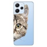 Senada Xiaomi Redmi 12 İle Uyumlu Kılıf Kamera Korumalı Silikon Desenli Resimli Kapak Kedi Prizma