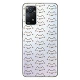Senada Xiaomi Redmi Note 11 Pro 5G İle Uyumlu Kılıf 0.4Mm Lazer Kesim Silikon Kedi Çizgi Uyumlu