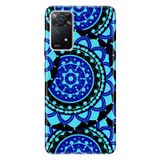 Senada Xiaomi Redmi Note 11 Pro 5G İle Uyumlu Kılıf 0.4Mm Lazer Kesim Silikon Mavi Mandala