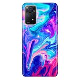 Senada Xiaomi Redmi Note 11 Pro 5G İle Uyumlu Kılıf 0.4Mm Lazer Kesim Silikon Mavi Pembe Ilizyon Uyumlu