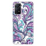 Senada Xiaomi Redmi Note 11 Pro Uyumlu 5G İle Uyumlu Kılıf 0.4Mm Lazer Kesim Silikon Mavi Mandala