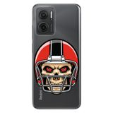 Senada Xiaomi Redmi Note 11E İle Uyumlu Kılıf 0.4Mm Silikon Desenli Kuru Kafa