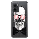 Senada Xiaomi Redmi Note 11E İle Uyumlu Kılıf 0.4Mm Silikon Desenli Moda Iskelet