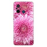 Senada Xiaomi Redmi Note 12 5G İle Uyumlu Kılıf Silikon Desenli Resimli Kapak Chon