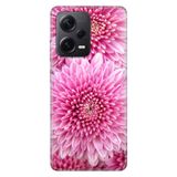 Senada Xiaomi Redmi Note 12 Pro 5G İle Uyumlu Kılıf Silikon Desenli Resimli Kapak Chon