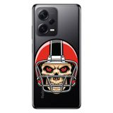 Senada Xiaomi Redmi Note 12 Pro 5G İle Uyumlu Kılıf Silikon Tioserisi Kuru Kafa