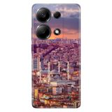 Senada Xiaomi Redmi Note 13 4G İle Uyumlu Kılıf Temalı Baskılı Silikon Ankara
