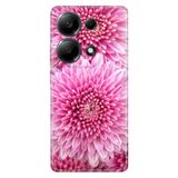 Senada Xiaomi Redmi Note 13 Pro 4G İle Uyumlu Kılıf Desenli Baskılı Silikon Chon