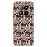 Senada Xiaomi Redmi Note 14 Pro Plus 5G İle Uyumlu Kılıf Desenli Silikon Pug Pug Köpek