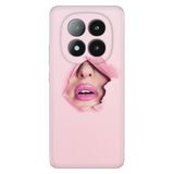 Senada Xiaomi Redmi Note 14 Pro Plus 5G İle Uyumlu Kılıf Desenli Silikon Saklı Aşk