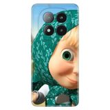 Senada Xiaomi Redmi Note 14 Pro Plus 5G İle Uyumlu Kılıf Desenli Silikon Türban